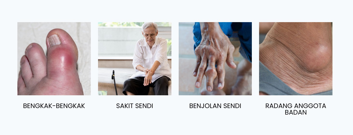 Tanda-tanda masalah sendi: bengkak, sakit sendi, benjolan sendi dan radang anggota badan